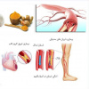 تصلب شرائین و درمان آن با گیاهان دارویی