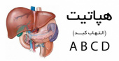 ۹۰ درصد مبتلایان به هپاتیت از بیماری خود خبر ندارند