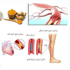 تصلب شرائین و درمان آن با گیاهان دارویی