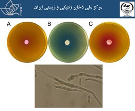 امکان غربالگری و تولید آنزیم آسپارژیناز با استفاده از سویه های تایپ مخمری