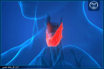 بانوان ۸ برابر بیشتر از آقایان در معرض ابتلا به کم کاری بافت تیروئید قرار دارند